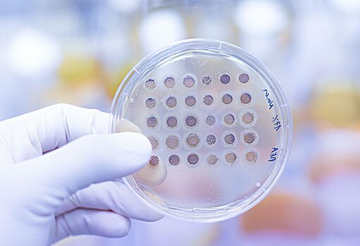 Gloved hand holding an agar plate